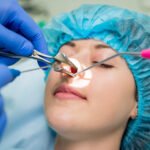 Sinus surgery specialist​
